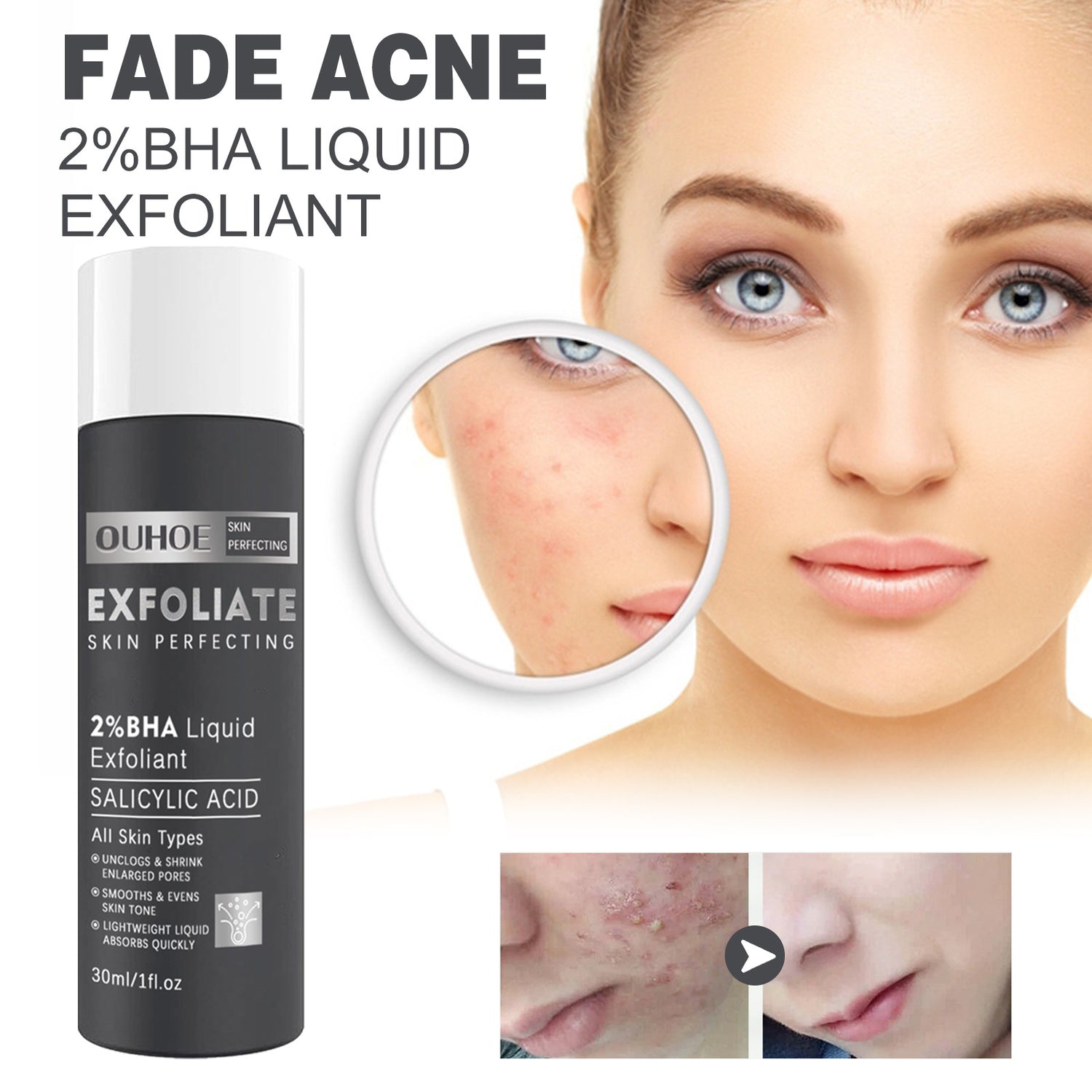 Salicylate Skin Repair Acne Skin Care Water - Beauty Alaska